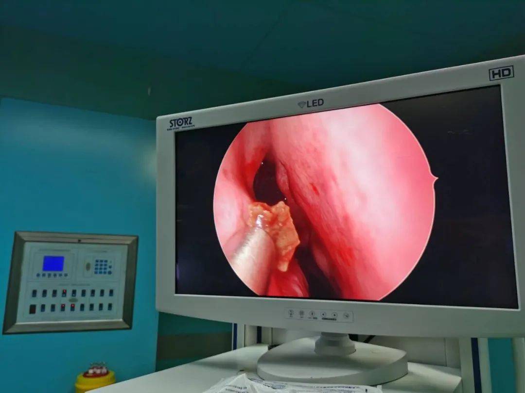 鼻窦炎微创手术价格揭秘,探索小巷深处的医疗宝藏