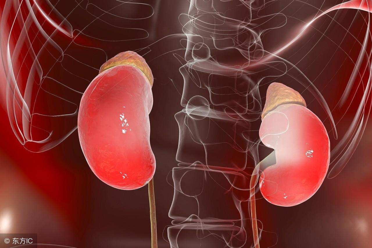 科技重塑肾脏健康,智能医疗时代马蹄肾的最新进展