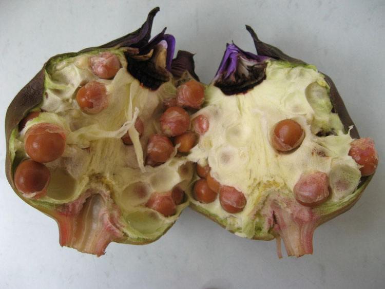 科技重塑肾脏健康,智能医疗时代马蹄肾的最新进展